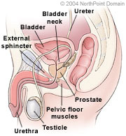 Enlarged prostate BPH Diagram