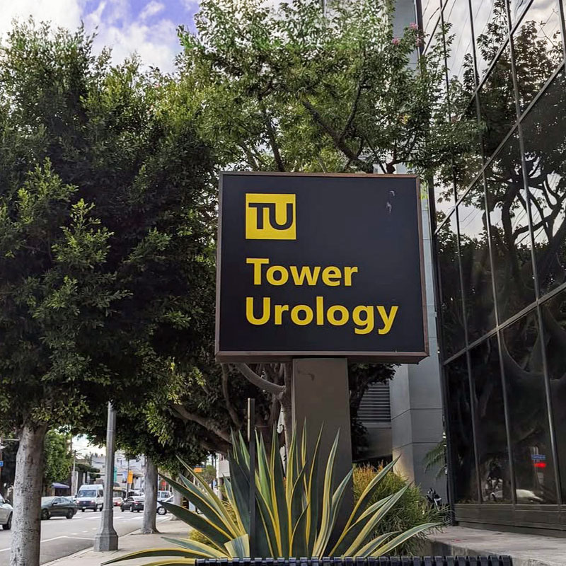 Tower Urology Sign