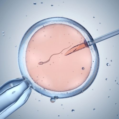 Artificial Insemination