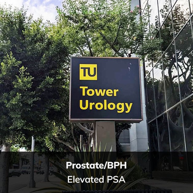 Tower Urology sign with emphasis on Prostate/BPH and Elevated PSA, located in Los Angeles, representing specialized care for prostate health.