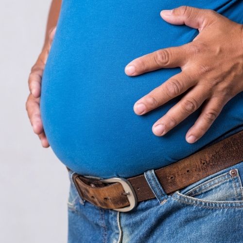 Kidney Stones Obesity 500x500