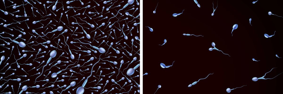 Oligospermia (low sperm count)_ Tower Urology