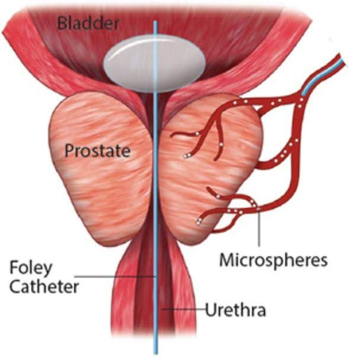 Prostate artery