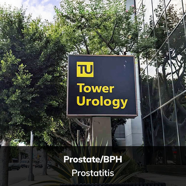 Prostatitis, Tower Urology