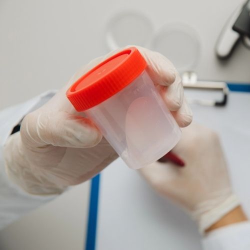 Sperm Semen Analysis_Tower Urology