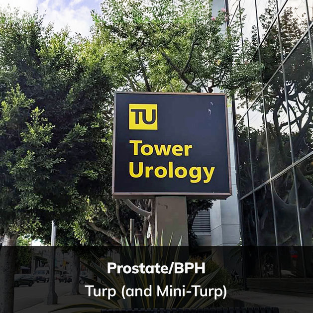 Turp (and Mini-Turp)-big_Tower Urology