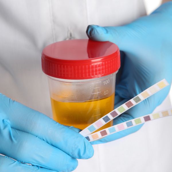 Urine Test Sample