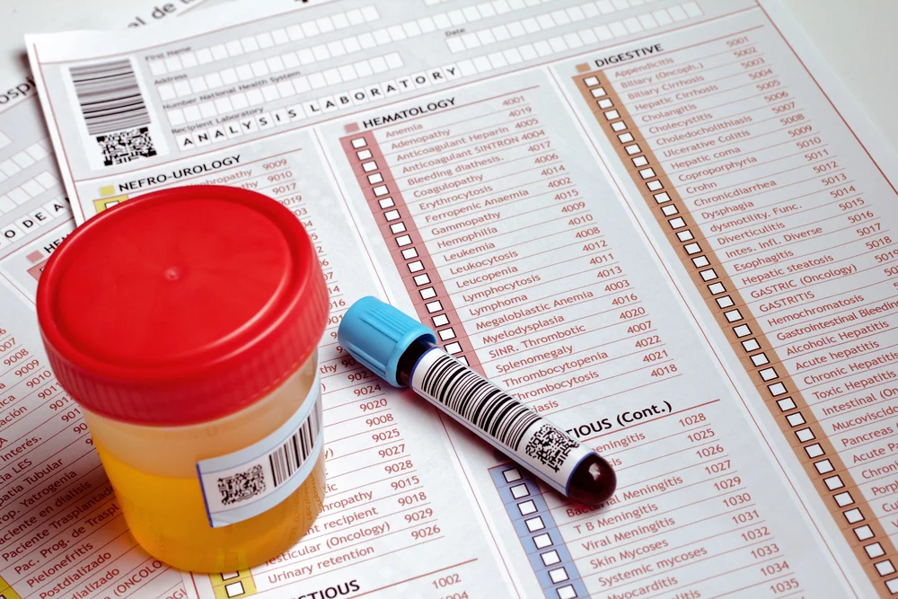 Hematuria_Medical Test_Tower Urology
