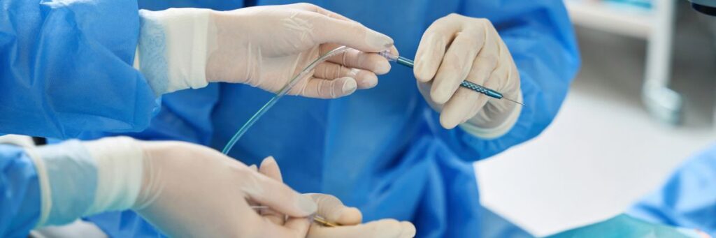 Microsurgical Varicocelectomy Varicocele Embolization 1200x400